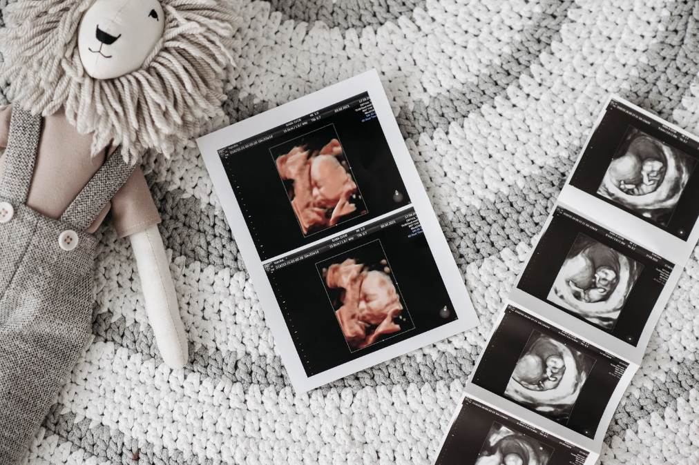 are scans safe in pregnancy?
